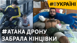 Історії важких поранень у запеклих боях: військові показують наслідки і відновлення | #ВУКРАЇНІ