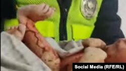 Уул бала суук жерде 3-4 саат жатып калганын, ал аябай үшүп калганын дарыгерлер маалымдаган.