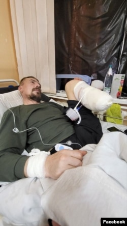 Руслан Троненко переніс 23 оперативні втручання