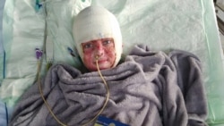 The Full Story Behind The Viral Testimony Of A Vinnytsya Survivor
