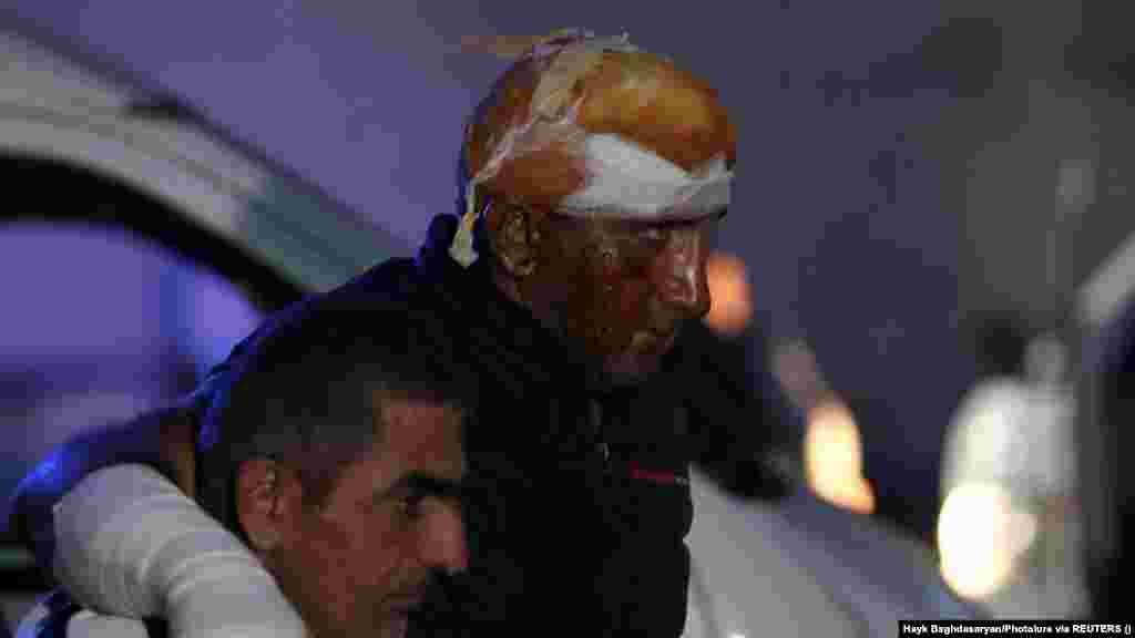 Мужчине, пострадавшему в результате взрыва на топливном складе недалеко от Степанакерта в Нагорном Карабахе, помогают выйти из машины скорой помощи. Его привезли в ожоговый центр в Ереване. Омбудсмен сепаратистского региона Гегам Степанян сообщил Армянской службе Радио Свобода, что в результате взрыва, по подтверждённым данным, погибли 68 человек. Взрыв произошёл, когда машины с людьми, направлявшимися в Армению, выстроились в очередь за бензином