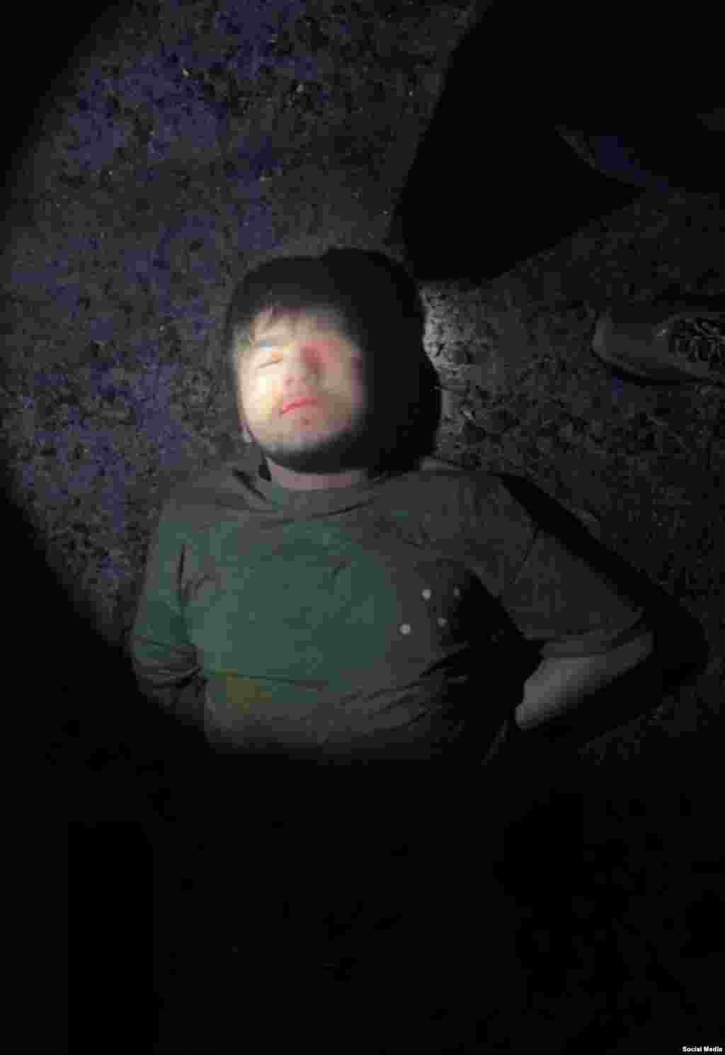 Muhammadsobir Faizov este fotografiat după ce a fost reținut pe 23 martie cu o leziune oculară aparent gravă, care a fost blurată de presa rusă.