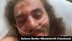 Activistul georgian Zuka Berdzenișvilli, la spital, după ce a declarat că a fost atacat pe 11 iunie.