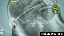 Схема експериментального проєкту із відновлення зору.