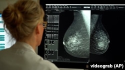 Учёные из Лундского университета (Швеция) предложили использовать искусственный интеллект для диагностики рака груди у женщин 