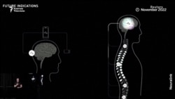 Маск кишинин мээсине Neuralink орнотот