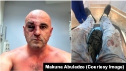 ლევან ხაბეიშვილს პოლიციელებმა სასტიკად სცემეს