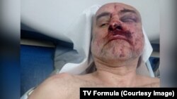 დავით ქაცარავას ფოტო კლინიკაში გადაყვანის შემდეგ არის გადაღებული.