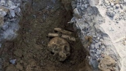 A Doctor Hid Bones Of Srebrenica Victims In His Garden. He's Still Practicing.