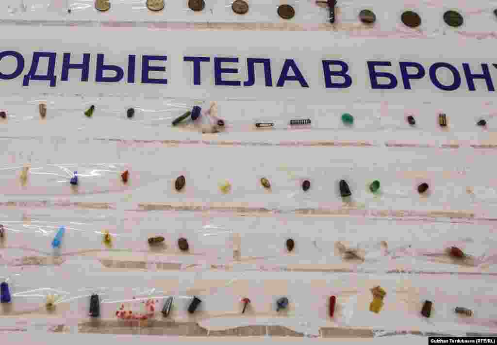 Балдардын өпкө, ашказан, ичегилеринен чыккан майда нерселер.&nbsp;