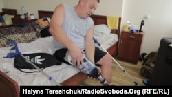 Протез Владислав знімає легко