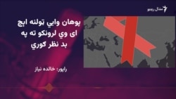 فعالان: په اېچ ای وي اخته نرښځیان باید هرومرو علاج وکړي 