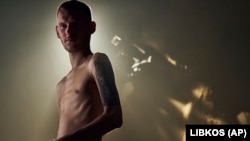 Dmytro Kozatskiy, udhëheqës i shërbimit për media të Brigadës Azov, fotograf dhe mbrojtës i Mariupolit, tregon trupin e tij të dëmtuar sa ka qenë në duart e forcave ruse dhe më pas është liruar përmes këmbimit të të burgosurve.