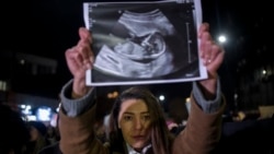 'Kad porođaj počne, žena ne može da ustane i ode' 