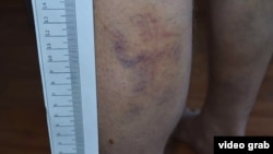 Several Jehovah's Witnesses say they were tortured by police after raids in Surgut.