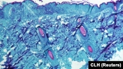 Imagine la microscop al unui țesut cutanat al unei maimuțe infectate. 1968