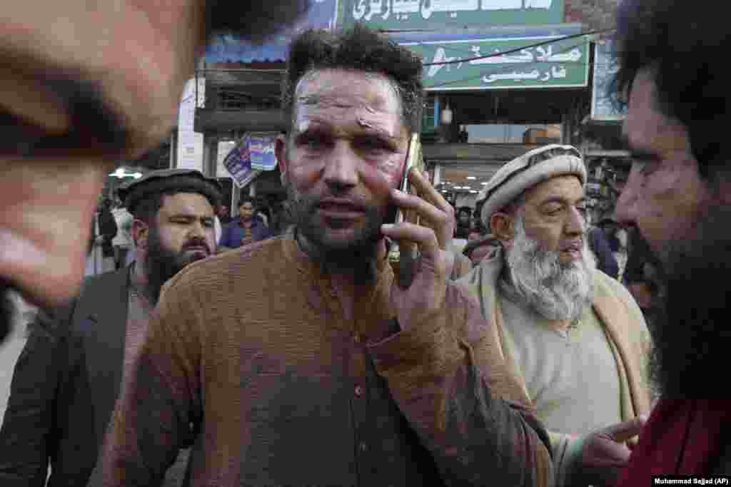 An injured victim talks on his mobile phone after getting treatment outside a hospital in Peshawar. The incident comes nearly a year after a suicide bombing killed 63 people in a Shi'a mosque in Peshawar. &nbsp;
