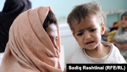 تصویر آرشیف: یکی از کودکان مبتلا به سوء تغذیه در ولایت کندهار
