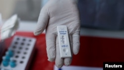 Iz SZO navode da je XBB.1.5 najprenosiviji podsoj omikrona koji je do sada otkriven.