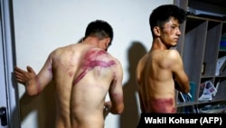 دو تن از خبرنگاران افغان که مدعی اند حین پوشش یکی از تظاهرات در کابل از سوی طالبان دستگیر و لت‌وکوب شده‌اند.