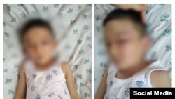 Өгөй атасынан кордук көргөн баланын бети жашырылган сүрөтү.