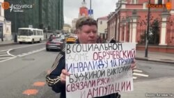 Постоялице ПНИ "Обручевский" ампутировали кисти рук
