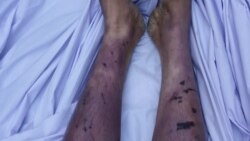 "لُور يې درې کاله وروسته په کفن کې راته راوړه"