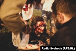 Марыя Зайцава, параненая ў ноч пратэстаў пасьля выбараў, Менск, ноч з 9 на 10 жніўня 2020