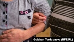 Бейтаптар бир бөлүмдө узак убакыт дарылангандыктан бири-бири менен дос болуп калышат.