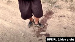 Aleksandr Melkumian steps in the blood stains of his slain mother-in-law in his front-line village of Martuni in Nagorno-Karabakh. 