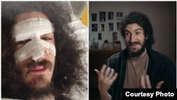 ფოტოკოლაჟი: ზვიად მაისაშვილი მასზე ძალადობიდან რამდენიმე საათში და BBC-ს მასალაში