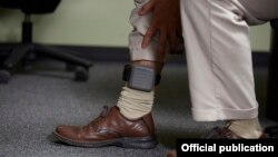 Электронный браслет для слежки за подозреваемым. Иллюстративное фото