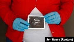 Кыргызстанда коронавирус башталгандан бери бул оору жугуп 18 кош бойлуу аял каза болду. Саламаттык сактоо министрлигинин маалыматы боюнча 2020-жылдын март айынан сентябрга чейин 849 кош бойлуу аялга коронавирус диагнозу коюлду.