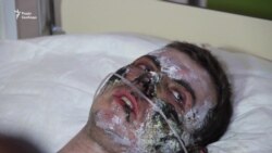 Стан потерпілих гірників «Степової» стабільний – лікар львівського шпиталю (відео)