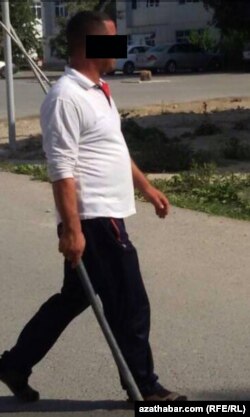 Öýsüz itleri öldürmäge çekilen işgär (arhiw suraty)