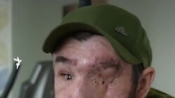 «Я рад, что жив. А то, что не вижу в жизни... Я уже многое увидел». История украинского бойца