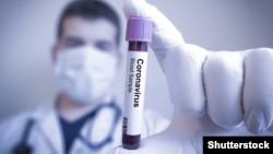 Тест на выявление коронавируса. Иллюстративное фото.  