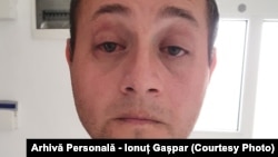 Alergia la ambrozie i-a afectat lui Ionuț Gașpar și starea psihică.