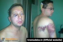 Сергій Нужненко (фото: hromadske.tv)