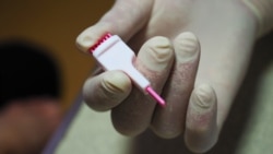 Экспресс-тест