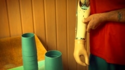 Протезна майстерня у Харкові, фотографія з книги «Ампутація»