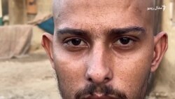 پاکستان کې مېشت ناروغه افغان کډوال له مشکل سره مخ شوي