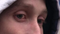 «Говорили, що ми дітей їмо» – український військовий про перебування в полоні (відео)