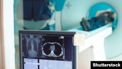 جریان آزمایش ام آی آر یک فرد مشکوک به بیماری سرطان. عکس از آرشیف