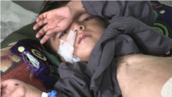 په افغانستان کې خوارځواکي هغه ناروغي ده چې میلیونونه ماشومان پرې اخته دي.
