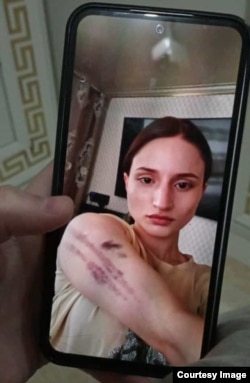 Баймурадова Iайшат, цIерачара йиттина таммагIашца