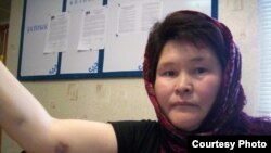 Эльвира Жақсылықова қолындағы көгерген іздерді көрсетіп тұр. Суретті "Алға" партиясының өкілдері  түсірген. Ақтөбе, наурыз, 2010 жыл. 