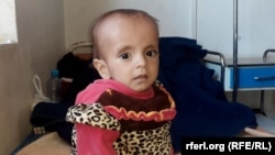 یکی از کودکان مبتلا به سوء تغذی