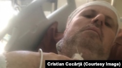Cristian Cocârță, în spital la Milano, arată zona în care a fost operat la corzile vocale