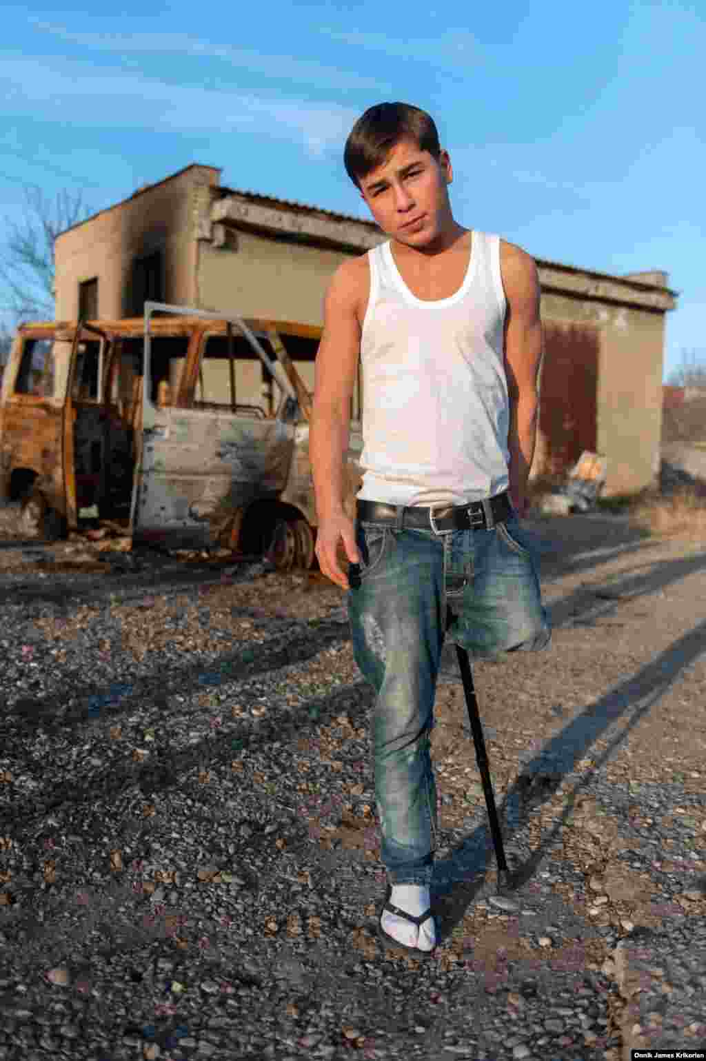 ბავშვთა უფლებების დაცვის კუთხით გატარებული რეფორმების მიუხედავად ქუჩაში მცხოვრები და მომუშავე ბავშვების რაოდენობა გაიზარდა. გავრცელებული საზოგადოებრივი აზრის საპირისპიროდ, ყველამ არ მოინდომა, ამ გზას გაჰყოლოდა. რუსლანი ამის ერთ-ერთი მაგალითია. მას შემდეგ, რაც ერთ-ერთ მიტოვებულ მშენებლობაზე დაცვის მთვრალმა თანამშრომელმა მას შემთხვევით ფეხში ესროლა, რუსლანმა ფეხი დაკარგა. დოკუმენტების არქონის გამო მას ხელი არ მიუწვდებოდა განათლებაზე ან სოციალურ სერვისებზე. გლდანის კრიზისულ ცენტრში&nbsp;(ახლა დახურულია) ამ ფოტოს გადაღების შემდეგ World Vision-ი რუსლანს და მის მდგომარეობაში მყოფ სხვა მოზარდებს პასპორტების აღებაში დაეხმარა.&nbsp; &nbsp;